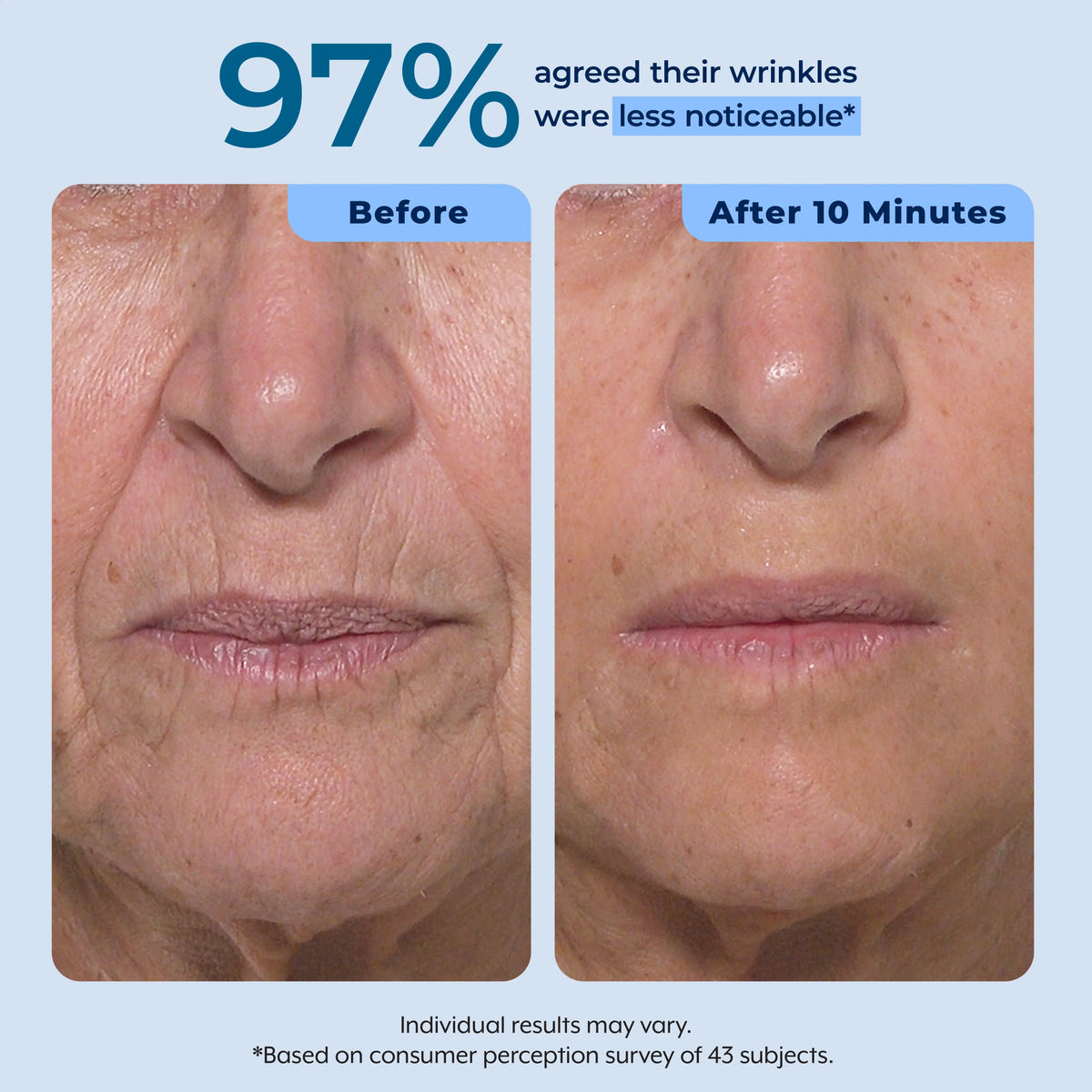 Rapid Reduction Serum – 1-Month Supply