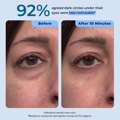 Rapid Reduction Serum – 1-Month Supply